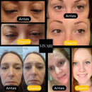 Face Pro© - Cuidado Avançado para um Olhar Renovado